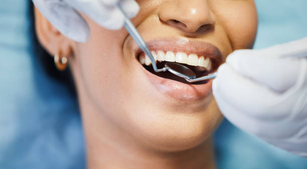 Best Emergency Root Canal Therapy in Taylorsville, MS